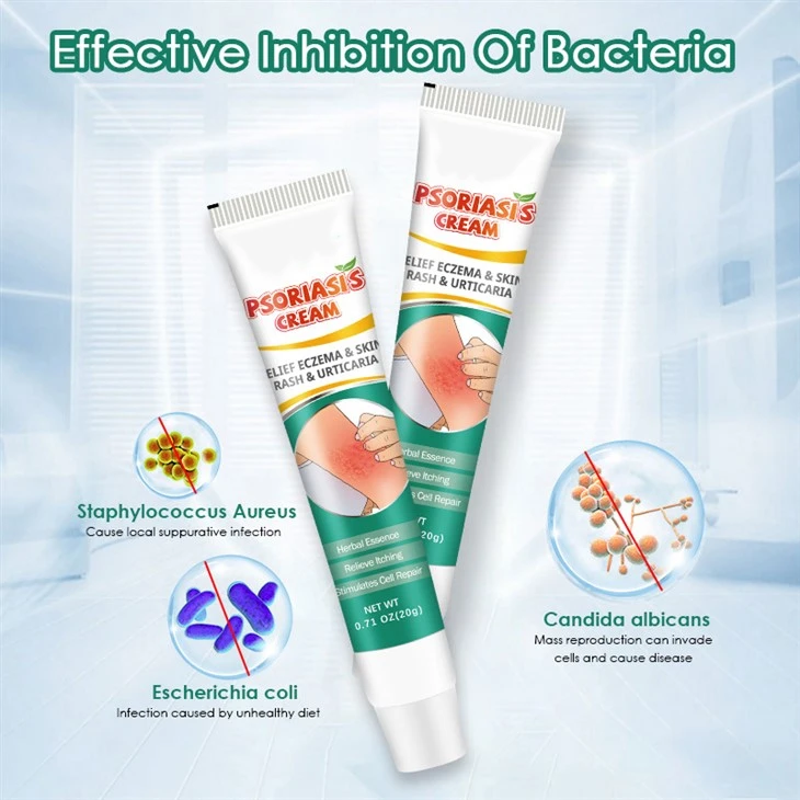 Dermatitis Pruritus Psoriasis Cream Ointment